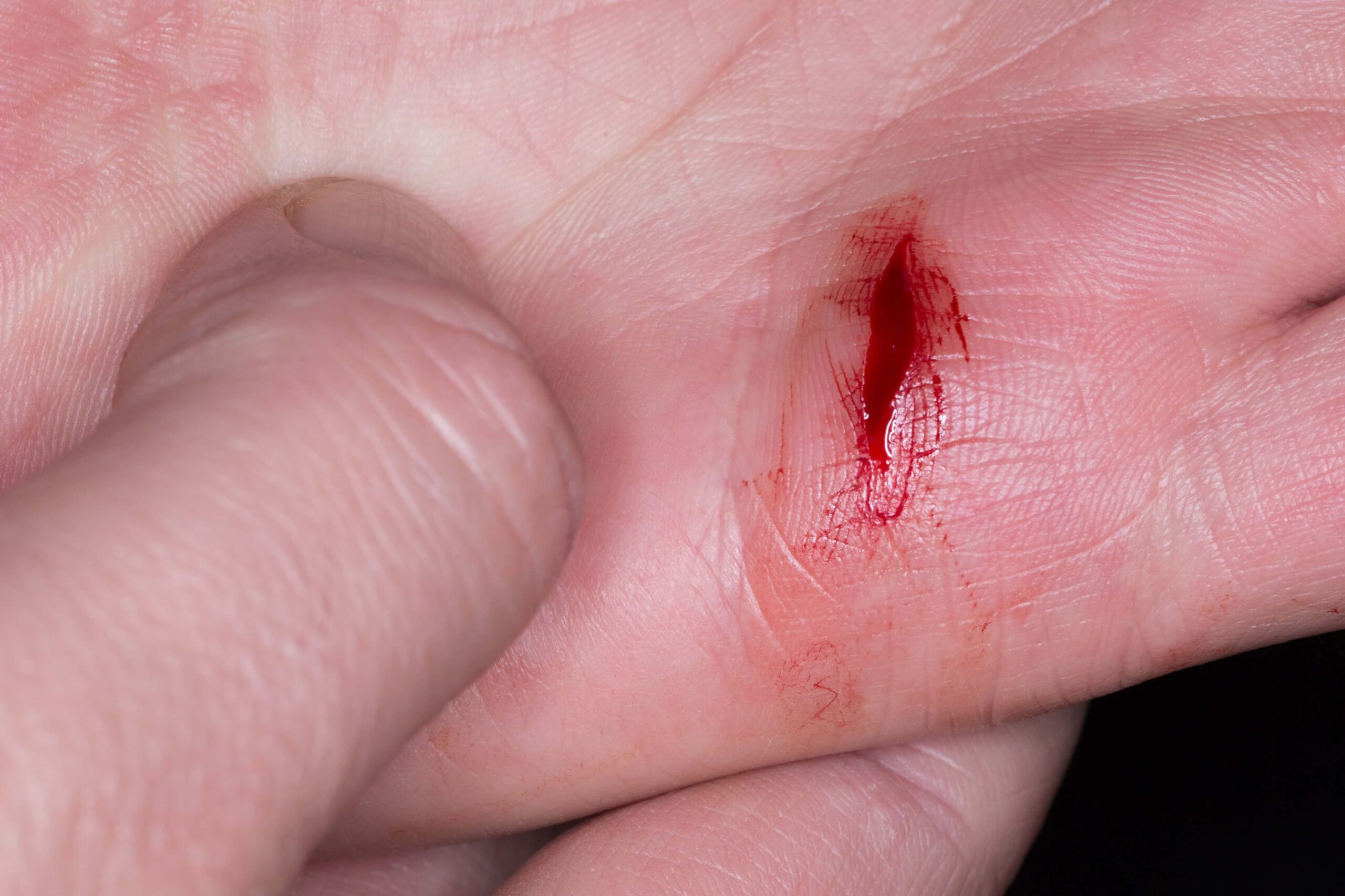 open-wound-healing-scaled